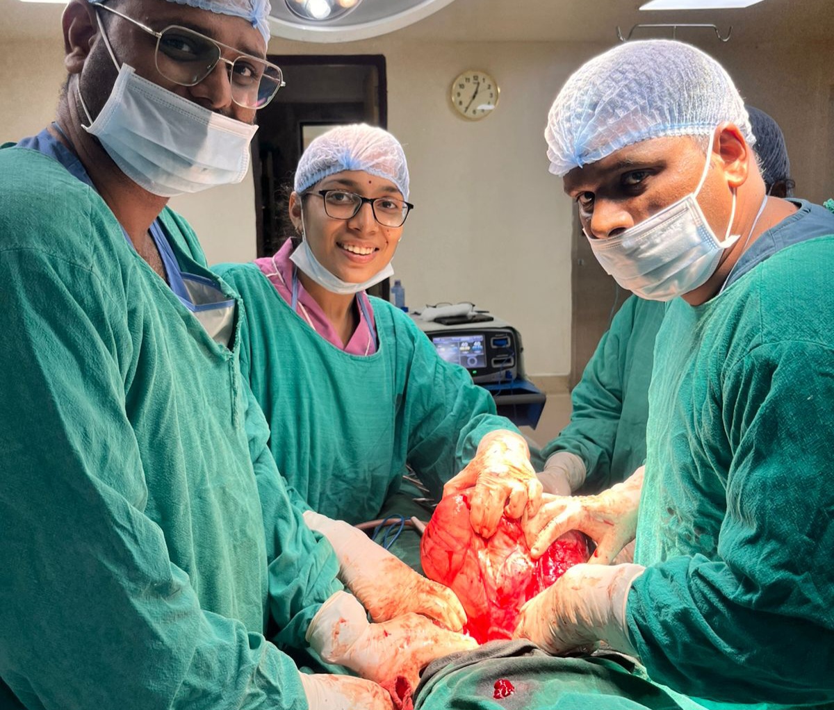 महिला के पेट से निकाला फुटबॉल के आकार का 8 किलो का ट्यूमर, आंतों से चिपका था फाइब्रॉएड; 3 विभागों की टीम ने दी नई जिंदगी