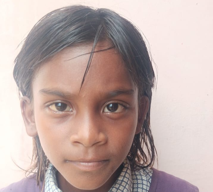 जशपुर की 8 वर्षीय स्वर्णि को मिली नई जिंदगी, दिल में था छेद, बिना ओपन हार्ट सर्जरी के रायपुर में सफल डिवाइस क्लोजर